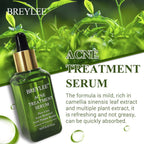 Breylee Acne Serum - Bye to Acne and Breakouts